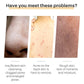 Lanthome Turmeric Soap Face Cleansing Anti Acne Skin Brighten Remove Pimples Dark Spot