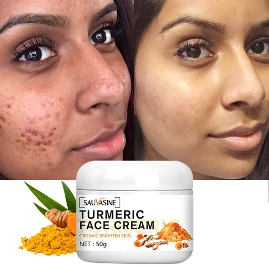 Turmeric Skin Whitening Cream for Dark Skin Acne Treatment Lighten Dark Spots Moisturizing Brightening Cream for Face Skin Care