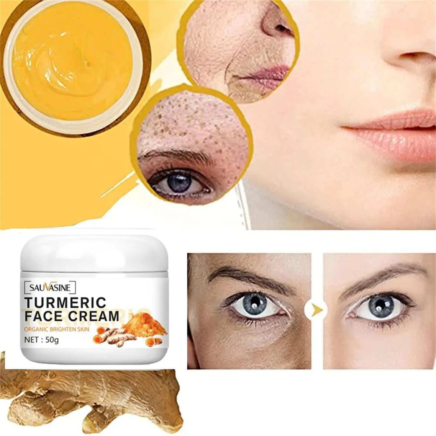 Turmeric Skin Whitening Cream for Dark Skin Acne Treatment Lighten Dark Spots Moisturizing Brightening Cream for Face Skin Care